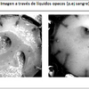 Imagen a travs de lquidos opacos (p.ej sangre)