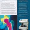 Implante caderas_documento