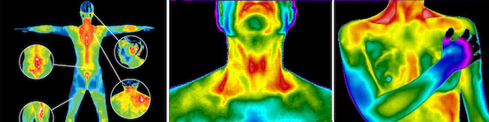 Termografia médica Termografia médica